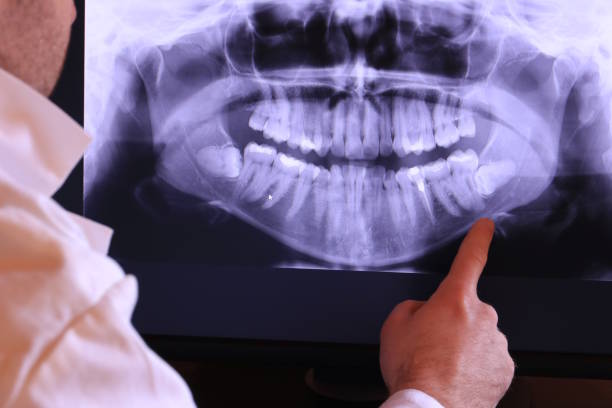 Trusted IN Emergency Dental Service Experts