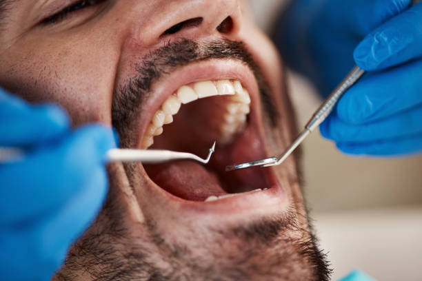 Best Weekend Emergency Dental Services in New Whiteland, IN